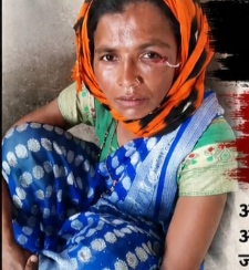 उपसरपंचाकडून आदिवासी महिलेस मारहान, निषेध मोर्चाचे आयोजन वंचितचा पाठिंबा                      
